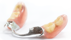 金属床義歯（下顎・６歯以下）