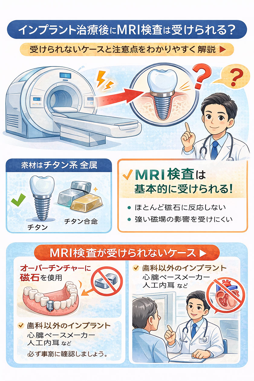 インプラント治療後にMRI検査は本当にできないの?