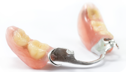 金属床義歯（上顎・６歯以下）