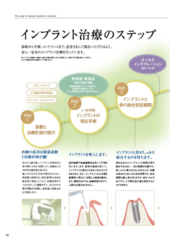 資料「インプラント治療の流れ」誌面（左ページ）