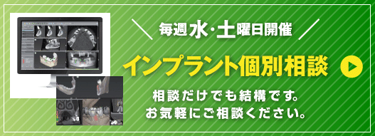 インプラント個別相談