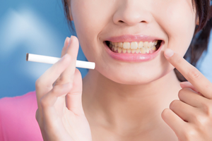 タバコと歯の黄ばみの関係